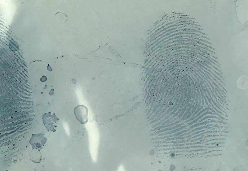 sudan black ca staining